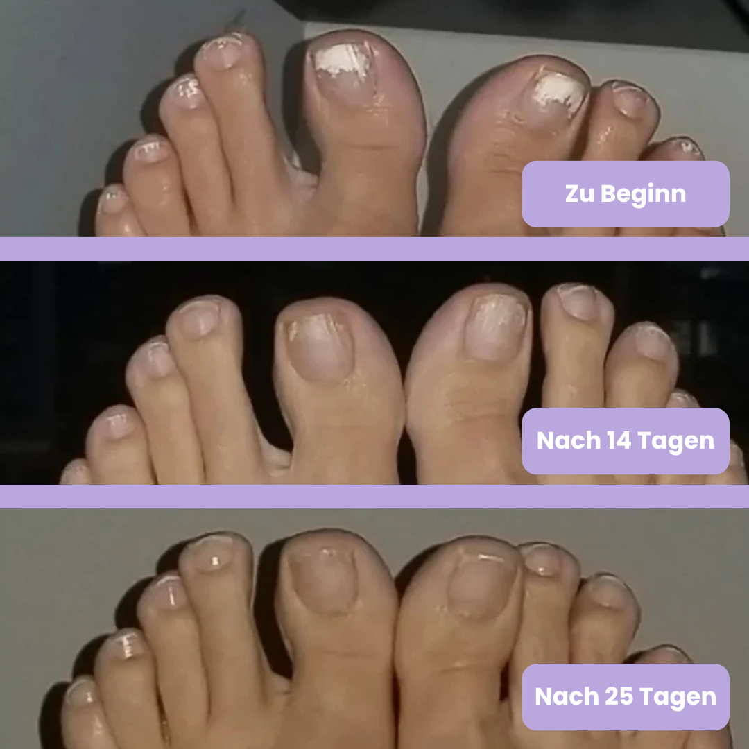 NailCare