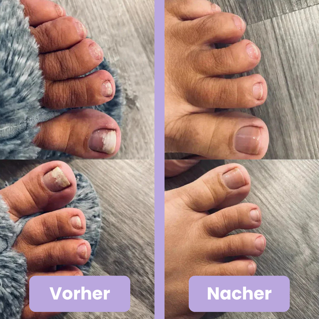 NailCare
